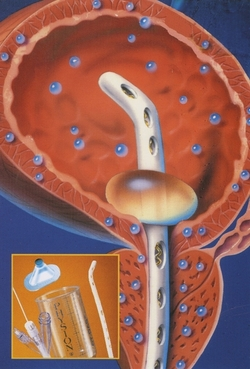 EMDA-vejiga